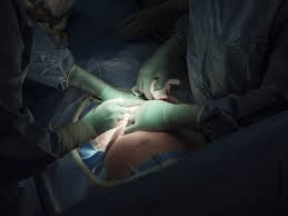 the-craze-for-caesarean-section-in-the-last-decade