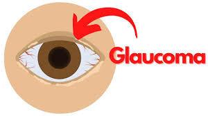 world-glaucoma-week:-40-year-olds-at-risk-nursing-officer