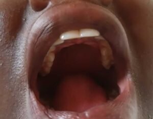 one-out-of-two-in-ghana-has-oral-health-disease-–-ohpag