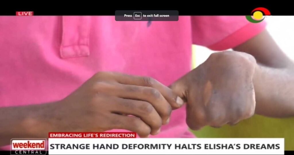 22-yr-old-overcomes-hand-deformity;-turns-coconut-shells-into-eco-friendly-items