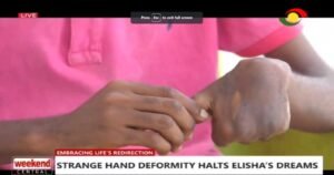 22-yr-old-overcomes-hand-deformity;-turns-coconut-shells-into-eco-friendly-items