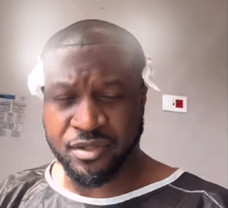 peter-okoye-of-p-square-fame-gets-a-hair-implant-in-turkey