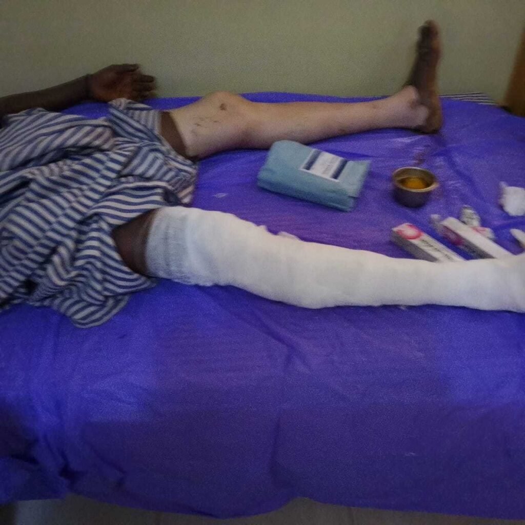 w/r-essikado:-premix-fuel-explosion-leaves-victims-in-critical-condition-at-ngyiresia